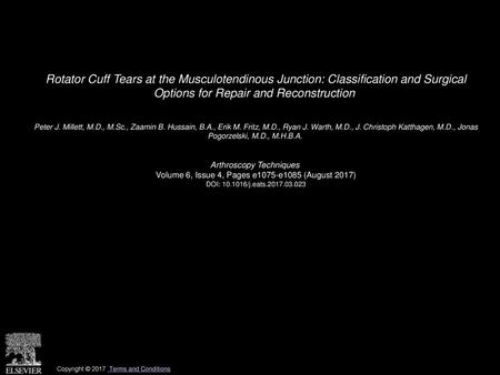 Rotator Cuff Tears at the Musculotendinous Junction: Classification and Surgical Options for Repair and Reconstruction  Peter J. Millett, M.D., M.Sc.,