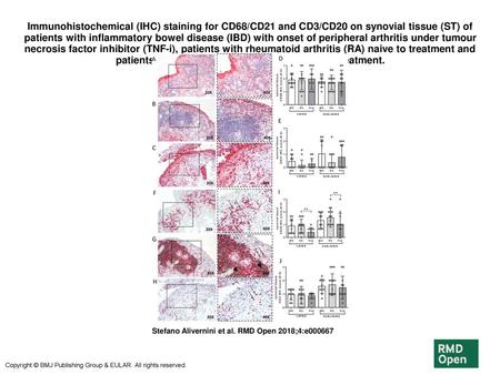 Immunohistochemical (IHC) staining for CD68/CD21 and CD3/CD20 on synovial tissue (ST) of patients with inflammatory bowel disease (IBD) with onset of peripheral.