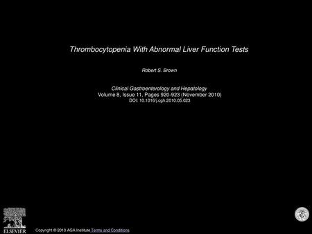 Thrombocytopenia With Abnormal Liver Function Tests