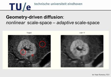 Ter Haar Romeny, FEV Geometry-driven diffusion: nonlinear scale-space – adaptive scale-space.