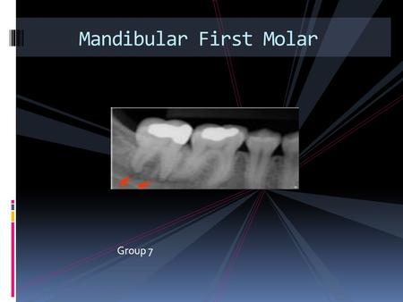 Mandibular First Molar