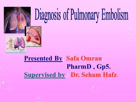 Diagnosis of Pulmonary Embolism