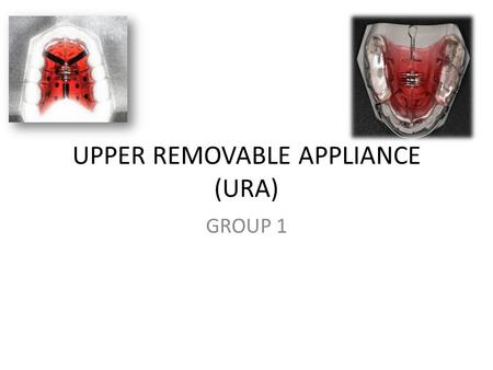 UPPER REMOVABLE APPLIANCE (URA)