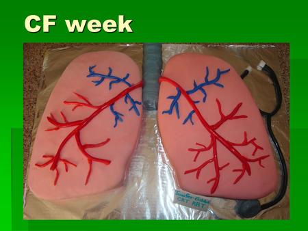 CF week. Anatomy of the LRT  Airway branchings & LMB vs RMB  Name levels from trachea to alveoli  Changes as we descend resp tract?  Pleural cavity.
