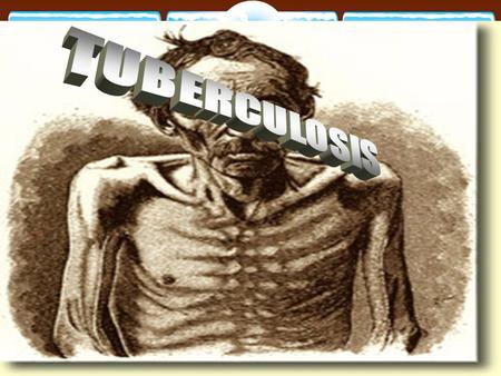 TUBERCULOSIS Pulmonary TB.