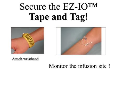 Secure the EZ-IO™ Tape and Tag! Monitor the infusion site ! Attach wristband.