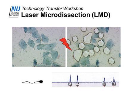 Technology Transfer Workshop Laser Microdissection (LMD)