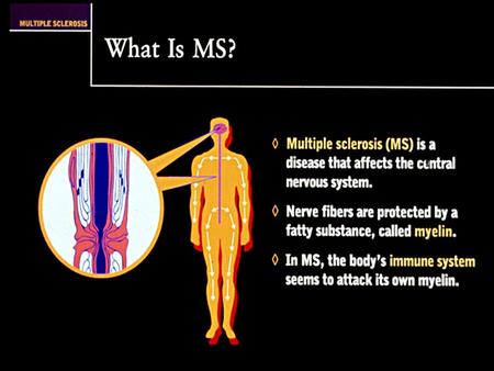 New Multiple Sclerosis Diagnostic Criteria CLINICAL ATTACKS OBJECTIVEADDITIONAL REQUIREMENTS 2 or more None; clinical evidence will suffice 2 or more1Dissemination.