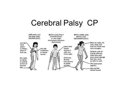 Cerebral Palsy CP.
