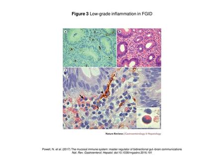 Figure 3 Low-grade inflammation in FGID