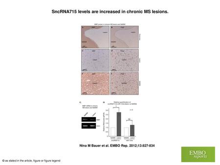 SncRNA715 levels are increased in chronic MS lesions.