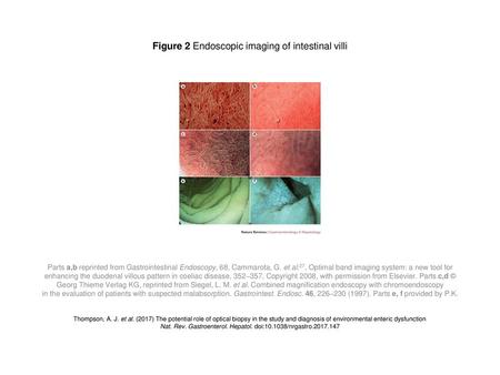 Figure 2 Endoscopic imaging of intestinal villi
