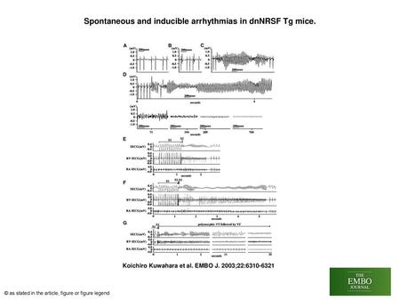 Spontaneous and inducible arrhythmias in dnNRSF Tg mice.