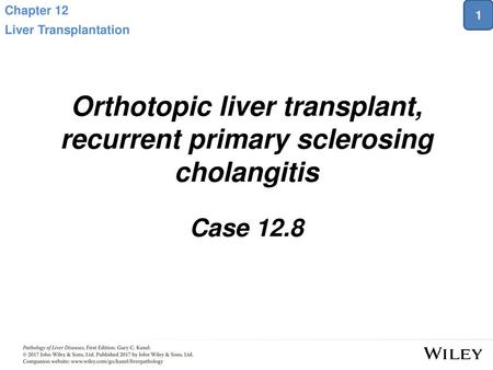 Orthotopic liver transplant, recurrent primary sclerosing cholangitis