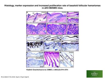 Histology, marker expression and increased proliferation rate of basaloid follicular hamartomas in ΔK5‐M2SMO mice. Histology, marker expression and increased.