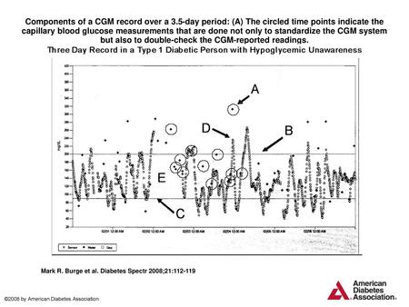 Components of a CGM record over a 3
