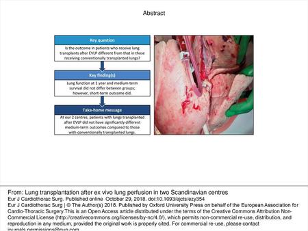 Abstract From: Lung transplantation after ex vivo lung perfusion in two Scandinavian centres Eur J Cardiothorac Surg. Published online October 29, 2018.