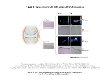 Figure 2 Representative MSI data obtained from human joints