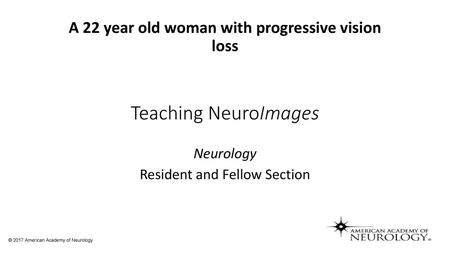 A 22 year old woman with progressive vision loss