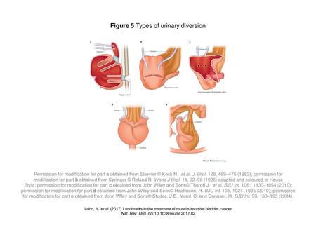 Figure 5 Types of urinary diversion