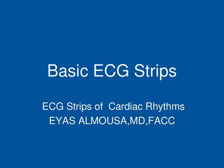 ECG Strips of Cardiac Rhythms EYAS ALMOUSA,MD,FACC