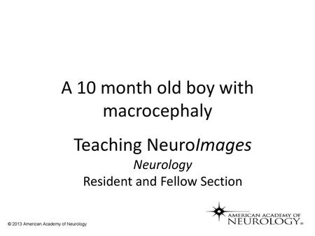 A 10 month old boy with macrocephaly