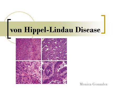 von Hippel-Lindau Disease