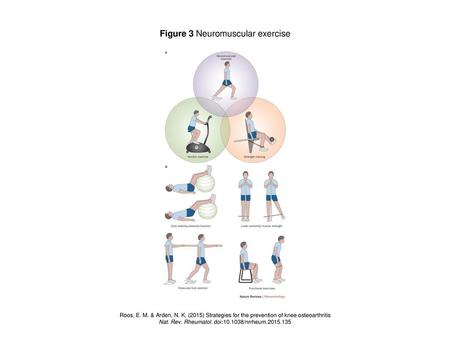 Figure 3 Neuromuscular exercise