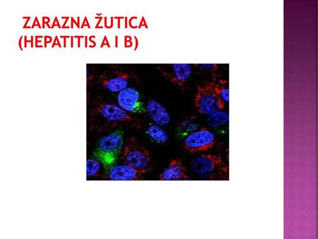 ZARAZNA ŽUTICA (hepatitis A i B)