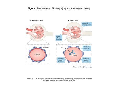Figure 1 Mechanisms of kidney injury in the setting of obesity