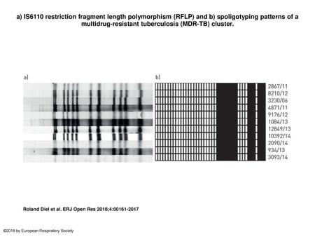 A) IS6110 restriction fragment length polymorphism (RFLP) and b) spoligotyping patterns of a multidrug-resistant tuberculosis (MDR-TB) cluster. a) IS6110.