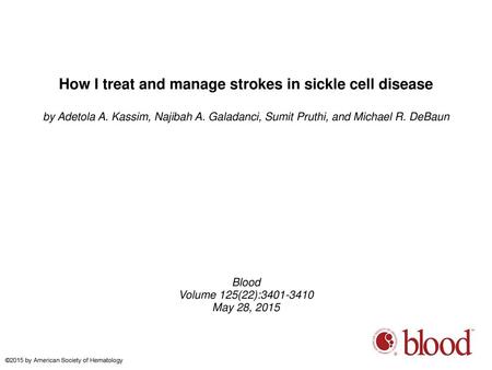 How I treat and manage strokes in sickle cell disease