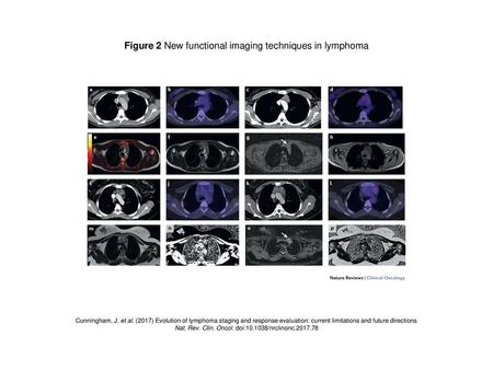 Figure 2 New functional imaging techniques in lymphoma