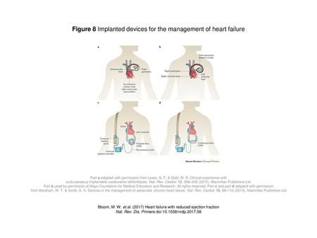 Figure 8 Implanted devices for the management of heart failure