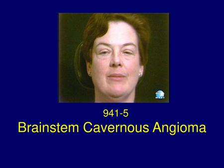 Brainstem Cavernous Angioma