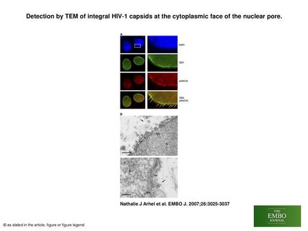 Detection by TEM of integral HIV‐1 capsids at the cytoplasmic face of the nuclear pore. Detection by TEM of integral HIV‐1 capsids at the cytoplasmic face.