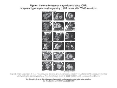 Figure 1 Cine cardiovascular magnetic resonance (CMR)