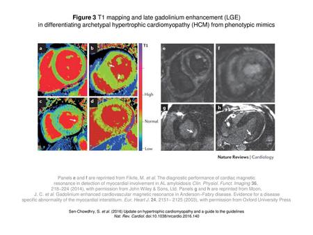 Figure 3 T1 mapping and late gadolinium enhancement (LGE)