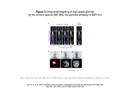 Figure 3 Intracranial targeting of high-grade gliomas