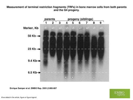 Measurement of terminal restriction fragments (TRFs) in bone marrow cells from both parents and the G4 progeny. Measurement of terminal restriction fragments.