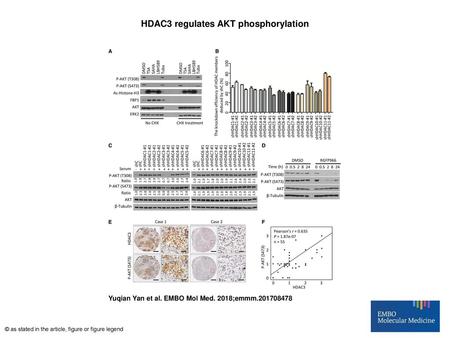 HDAC3 regulates AKT phosphorylation