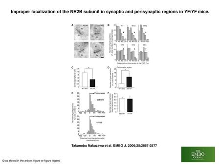 Improper localization of the NR2B subunit in synaptic and perisynaptic regions in YF/YF mice. Improper localization of the NR2B subunit in synaptic and.