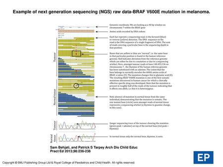 Example of next generation sequencing (NGS) raw data-BRAF V600E mutation in melanoma. Example of next generation sequencing (NGS) raw data-BRAF V600E mutation.