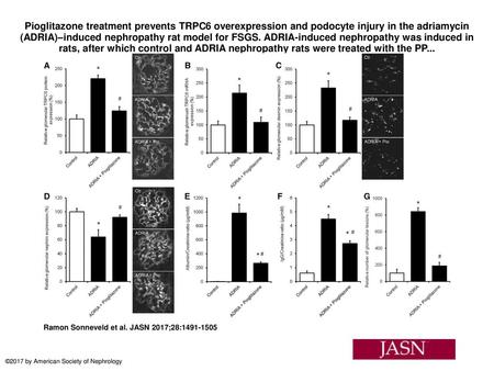 Pioglitazone treatment prevents TRPC6 overexpression and podocyte injury in the adriamycin (ADRIA)–induced nephropathy rat model for FSGS. ADRIA-induced.