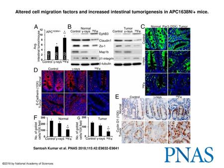 Altered cell migration factors and increased intestinal tumorigenesis in APC1638N/+ mice. Altered cell migration factors and increased intestinal tumorigenesis.