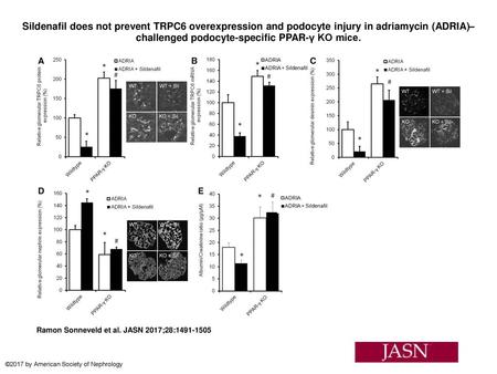 Sildenafil does not prevent TRPC6 overexpression and podocyte injury in adriamycin (ADRIA)–challenged podocyte-specific PPAR-γ KO mice. Sildenafil does.