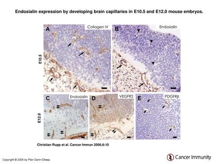 Endosialin expression by developing brain capillaries in E10.5 and E12.0 mouse embryos. Endosialin expression by developing brain capillaries in E10.5.