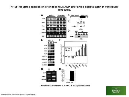 NRSF regulates expression of endogenous ANP, BNP and α‐skeletal actin in ventricular myocytes. NRSF regulates expression of endogenous ANP, BNP and α‐skeletal.