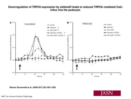 Downregulation of TRPC6 expression by sildenafil leads to reduced TRPC6–mediated Ca2+ influx into the podocyte. Downregulation of TRPC6 expression by sildenafil.