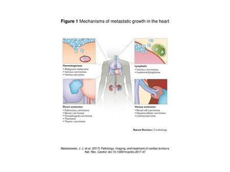 Figure 1 Mechanisms of metastatic growth in the heart